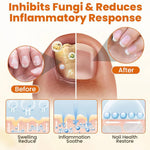 🐝FUNGI BEE - SPRAY - RESTAURADOR DE UÑAS ANTI-HONGOS CON VENENO DE ABEJA🐝