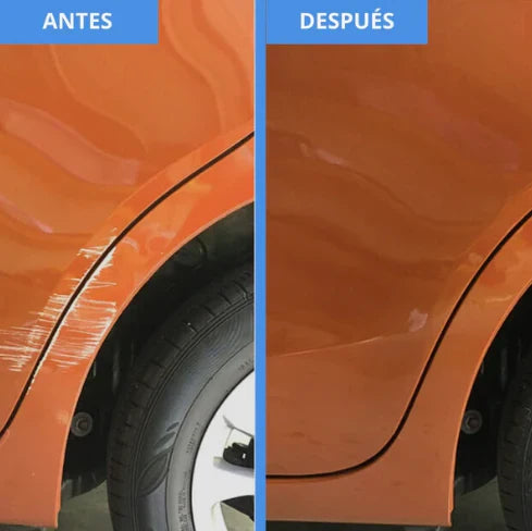 🏎️QUITA RAYONES - ULTIMAS UNIDADES🚗