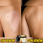 Crema premium BEE VENOM-QUITA VERRUGA Y TAGS DE PIEL🐝